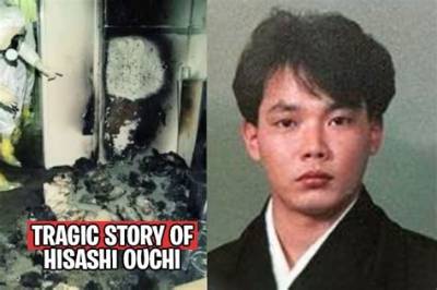 Hisashi Ouchi: the Tragic Story Behind the Real Photos from His Hospital Bed