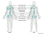 How Big Do Lymph Nodes Get with Lymphoma?