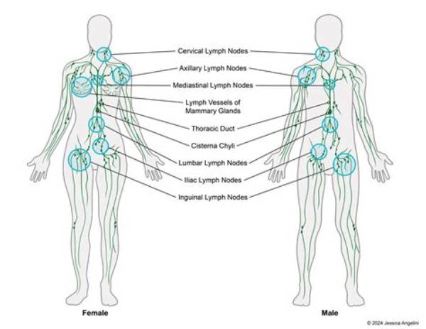 How Big Do Lymph Nodes Get with Lymphoma?