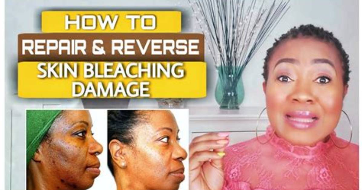 How Can I Bleach My Skin at Home?