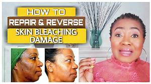 How Can I Bleach My Skin at Home?