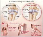 How Can I Fix My Nursemaid Elbow at Home?