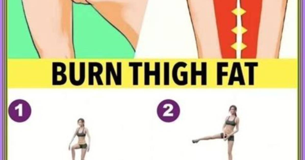 How Can I Lose Thigh Fat in a Week Without Exercise?