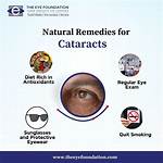How Can I Reduce Cataracts Naturally?