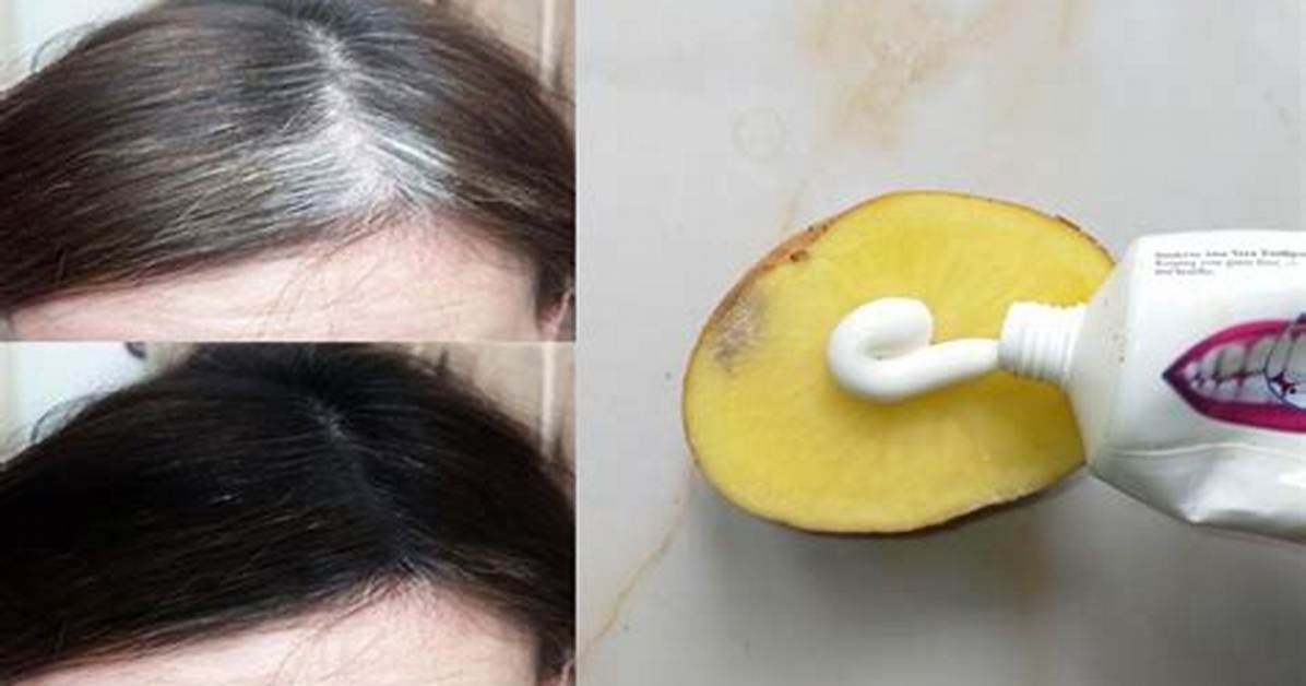 How Can I Remove White Hair Permanently Naturally?
