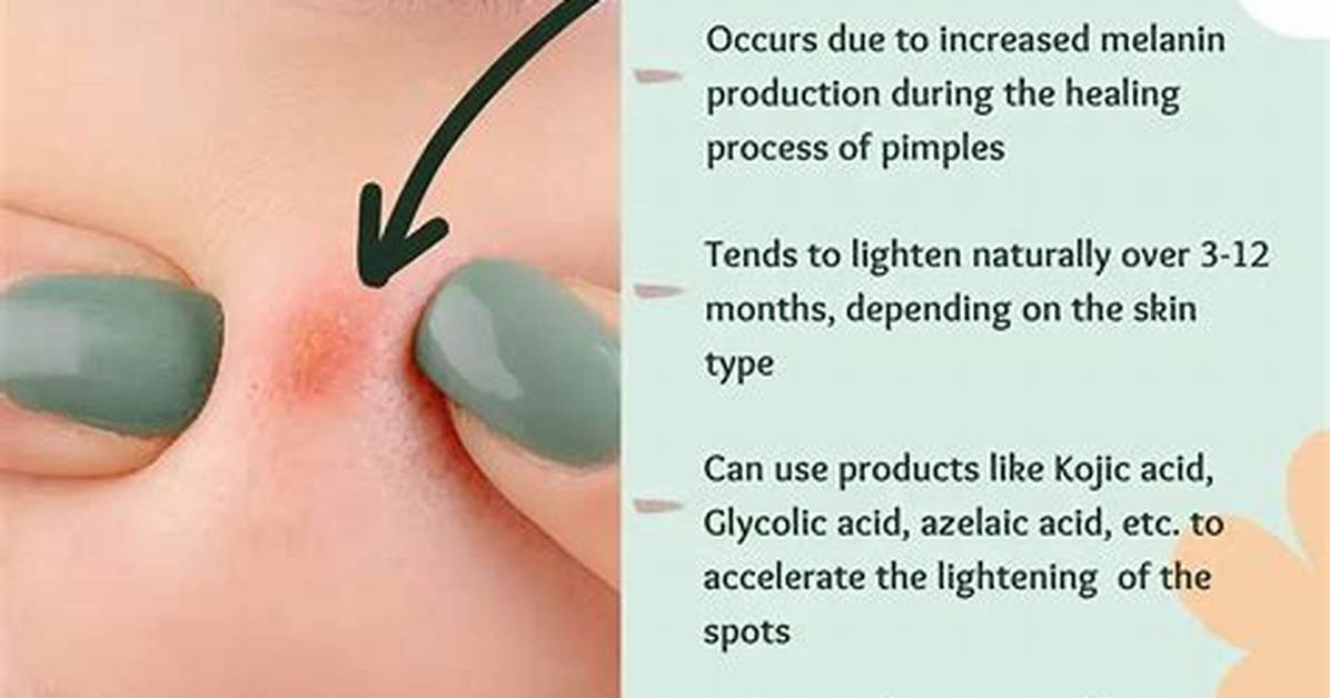 How Dermatologist Remove Dark Spots?