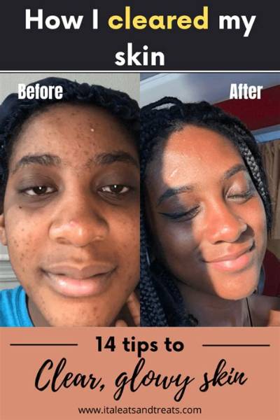 How Do Celebrities Get Clear Skin?