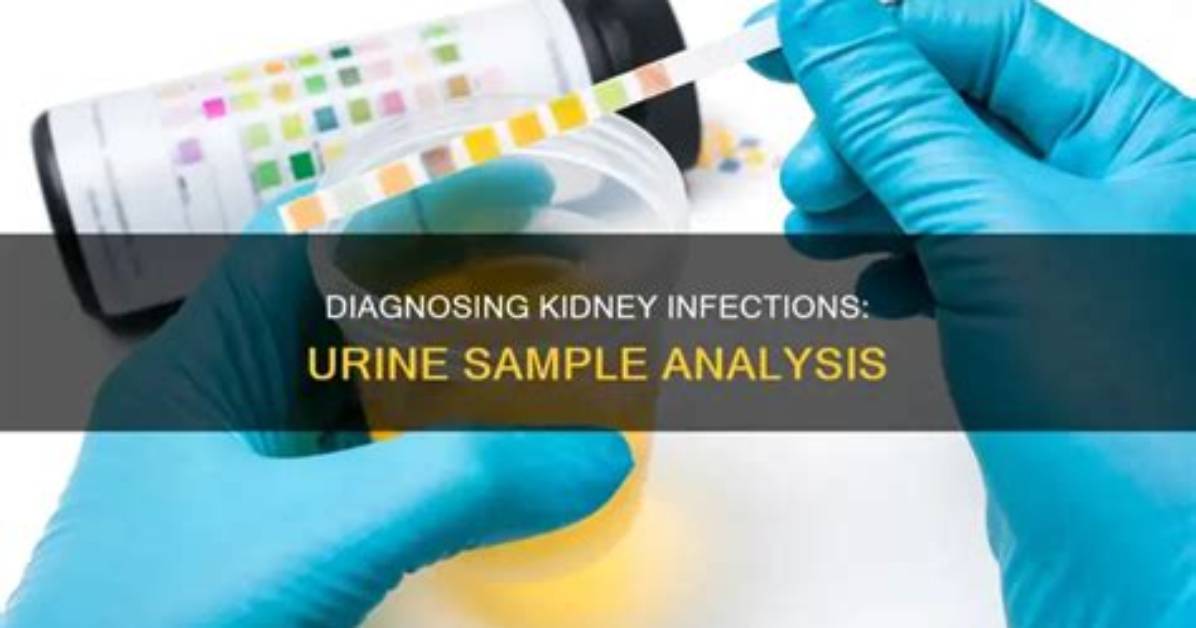How Do Doctors Check for Kidney Infection?