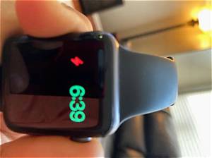 How Do I Clean My Apple Watch Sport Band Loop?