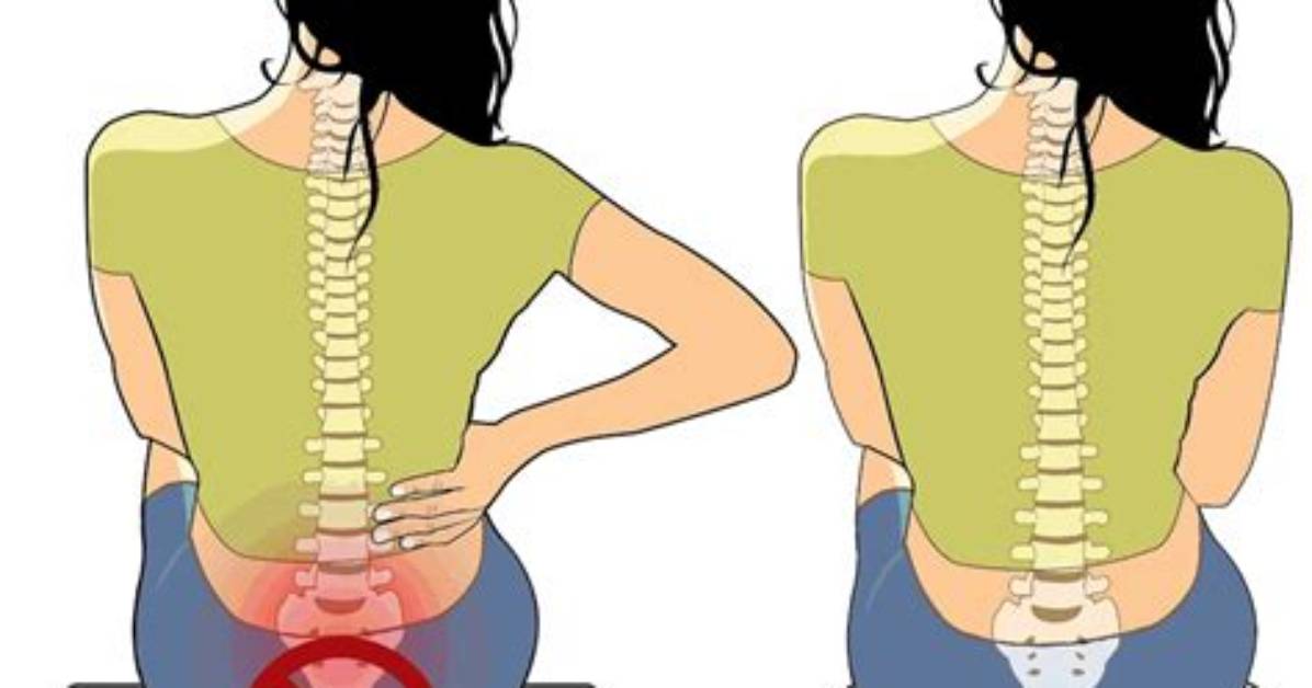 How Do I Know If Tailbone Pain Is Serious?