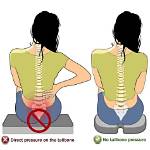 How Do I Know If Tailbone Pain Is Serious?