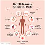 How Do I Know My Chlamydia Is Gone?