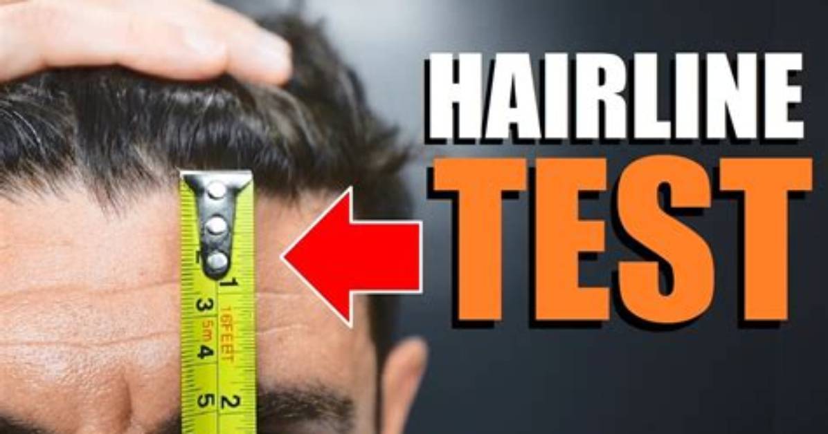 How Do I Test My Hairline?