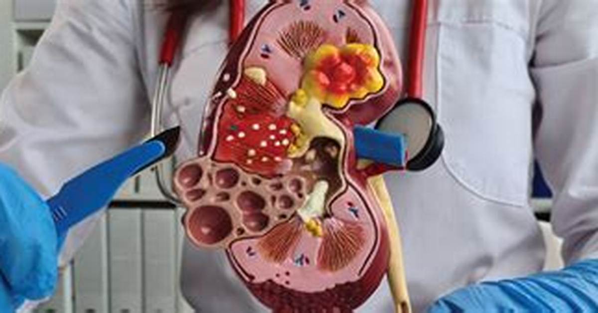How Do They Remove a Mass from Your Lung?