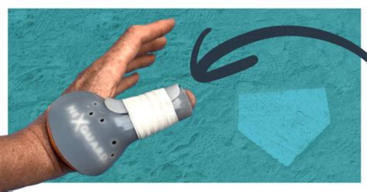 How Do You Cure Catcher's Thumb?
