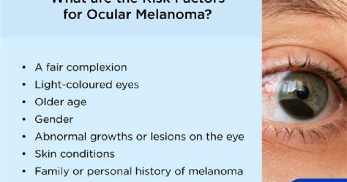 How Do You Diagnose Eye Melanoma?