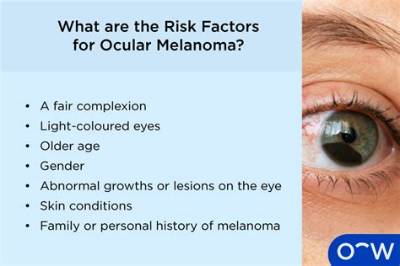 How Do You Diagnose Eye Melanoma?