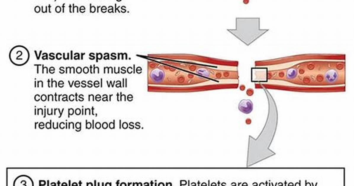 How Do You Dissolve a Blood Clot in Your Leg?