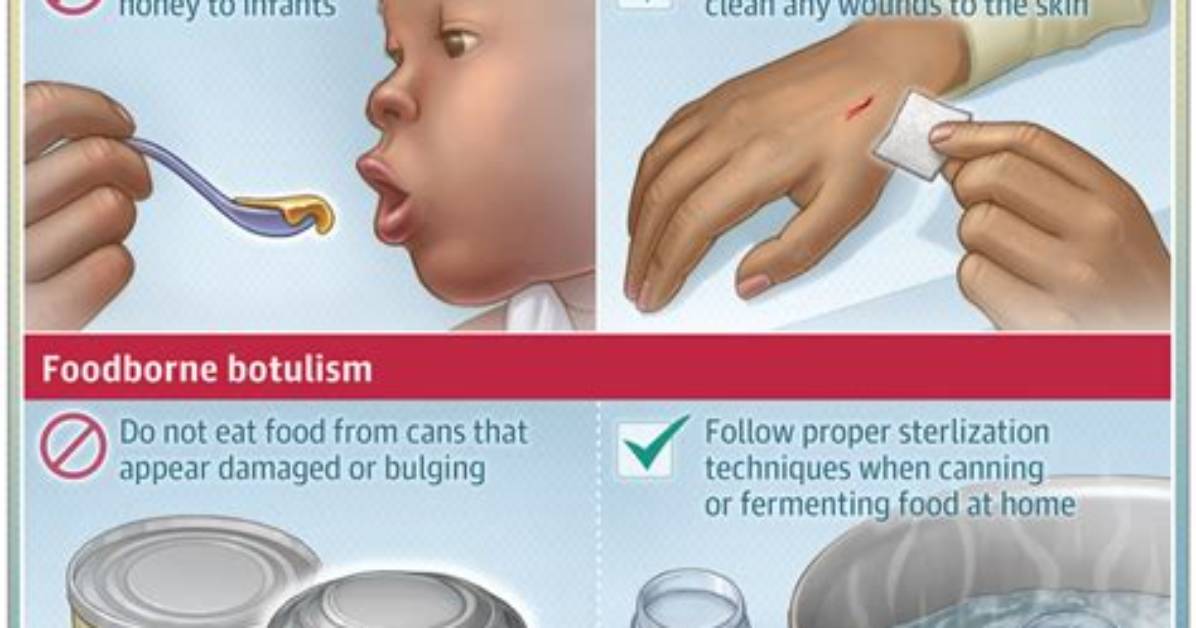 How Do You Get Botulism from Garlic?