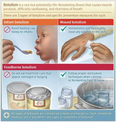 How Do You Get Botulism from Garlic?