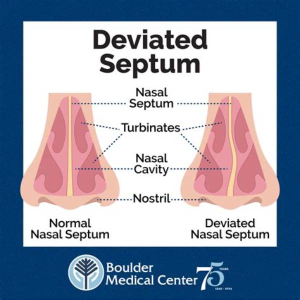 How Do You Know If Your Septum Is Perforated?