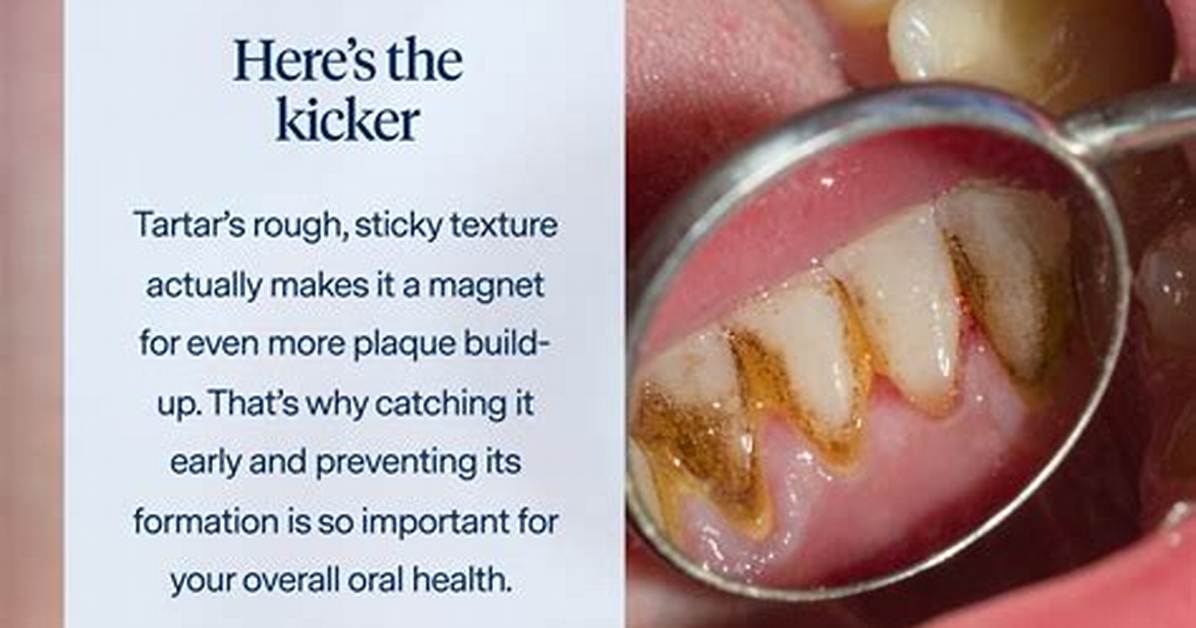 How Do You Remove Hardened Tartar?