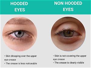 How Do You Stop Hooded Eyes?
