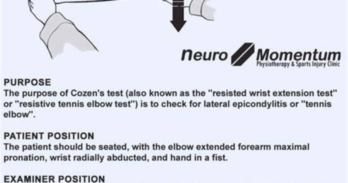 How Do You Test for a Mini Stroke?