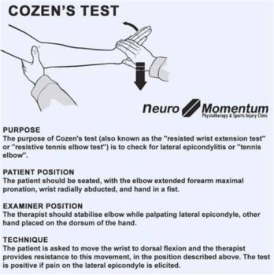 How Do You Test for a Mini Stroke?