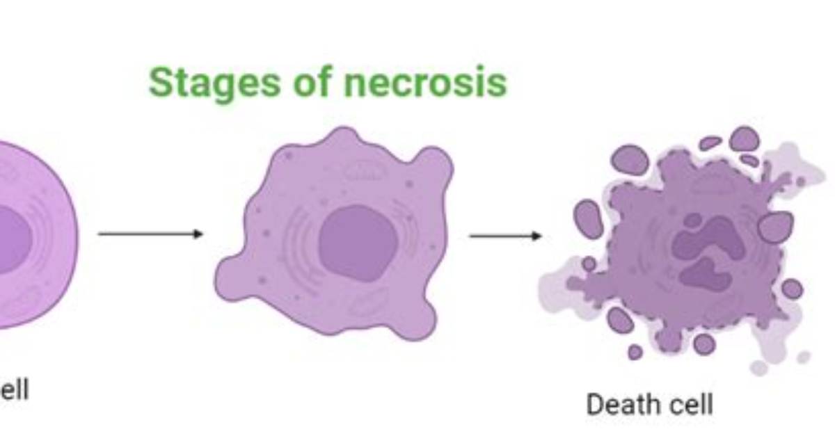 How Does Necrosis Happen?