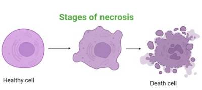 How Does Necrosis Happen?
