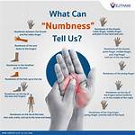 How Does Numbness Feel Like?