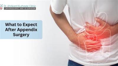 How Long After Appendix Surgery Can I Workout?