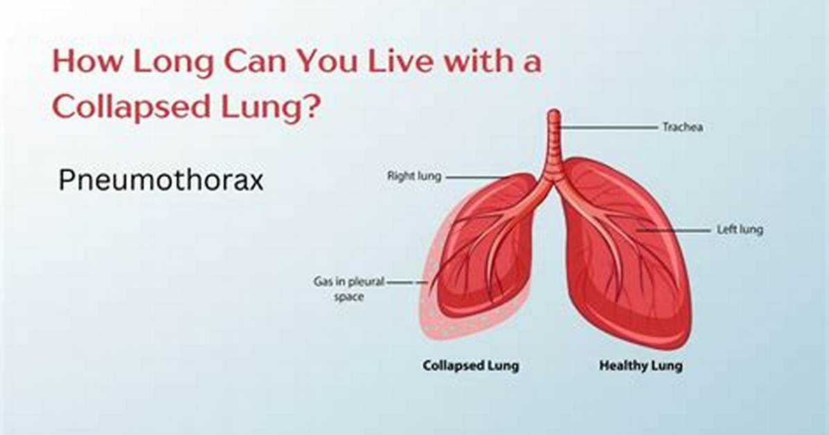 How Long Can You Live on 250K?