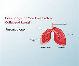 How Long Can You Live on 250K?