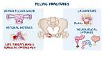 How Long Do Pelvic Fractures Take to Heal?