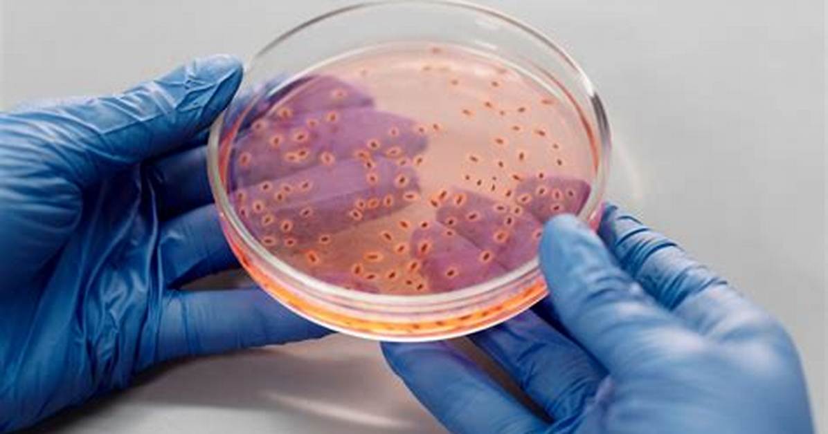 How Long Does a Bacterial Bloom Last?