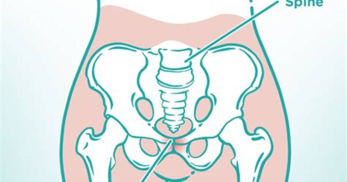 How Long Does Pain Last After Pelvic Fracture?
