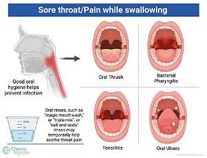 How Long Will My Throat Hurt After General Anesthesia?