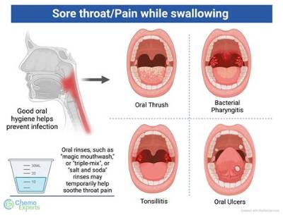 How Long Will My Throat Hurt After General Anesthesia?