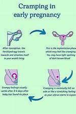 How Much Cramping Is Normal in Early Pregnancy?
