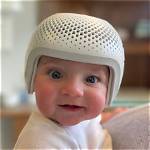 How Much Is a Baby Helmet?