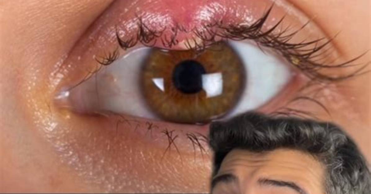 How Often Should I Lubricate My Eyes?