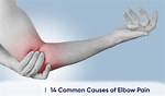How Painful Is Dislocating Your Elbow?