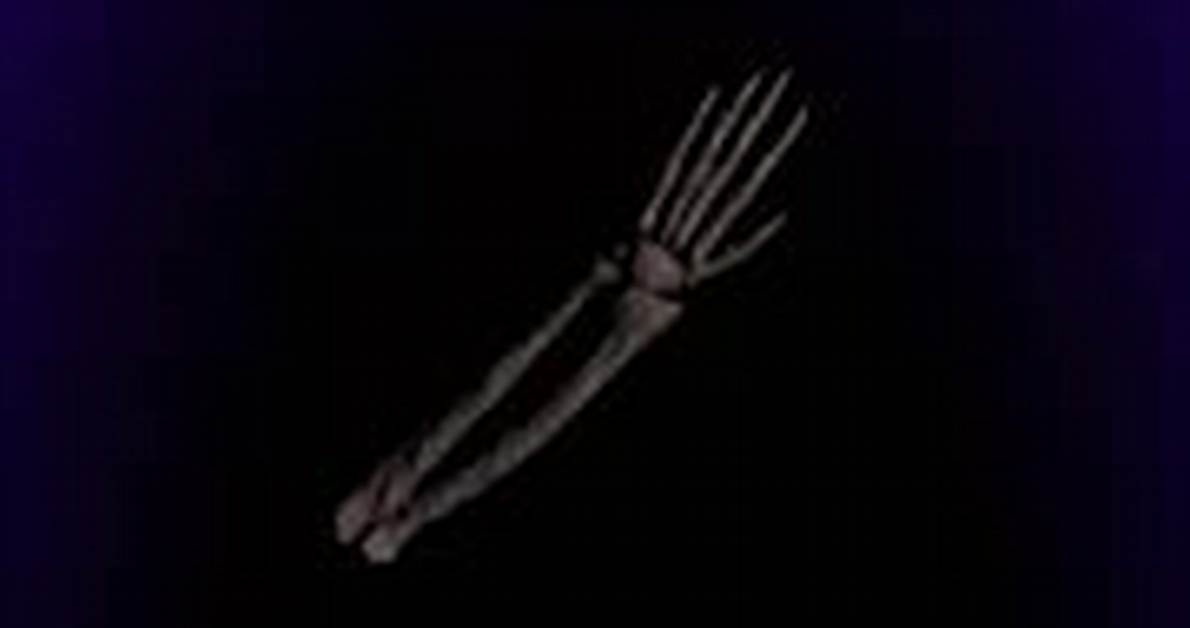 How Rare Is Saints Left Arm in Aut?