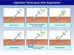 How to Avoid Aspiration When Injecting