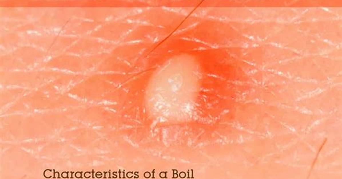 How to Boil Out