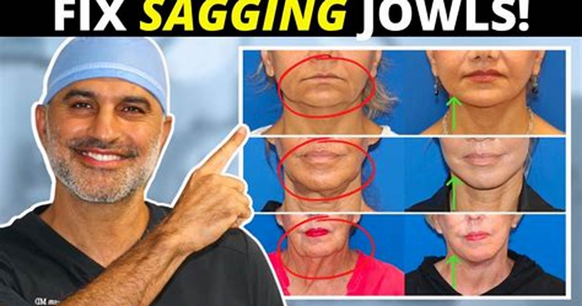 How to Correct a Sagging