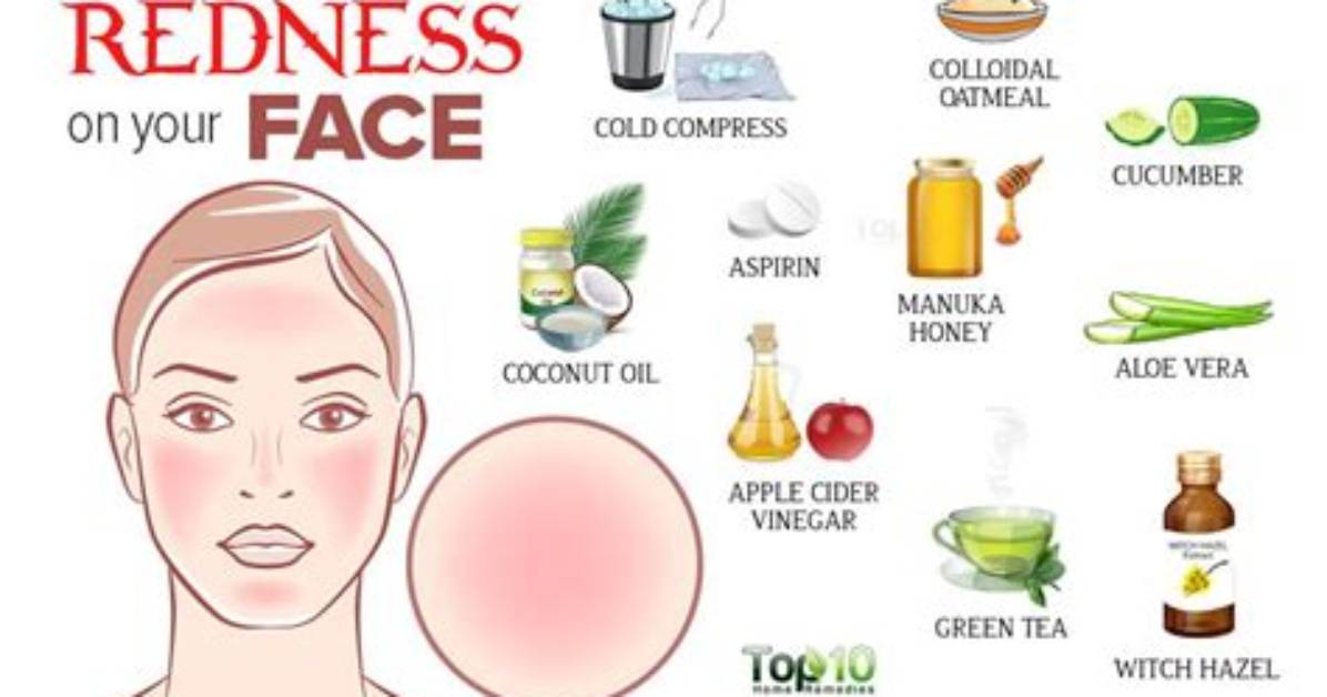 How to Cure Redness on Face Overnight?