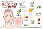 How to Cure Redness on Face Overnight?